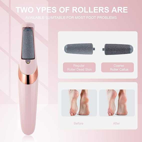 USB Rechargeable Foot Callus Remover – Electric File with LED Light & 2-Speed Settings for Smooth Feet